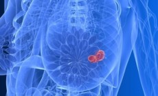 Reducing postmenopausal breast cancer